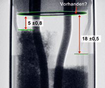 MIt RayCheck messen